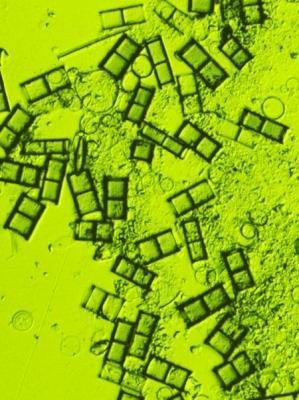 A microscopic image of diatoms, a type of phytoplankton, from a Lake Erie water sample. (Credit: Euan D. Reavie PhD, UMD)